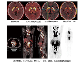 临床阶段影像学研究