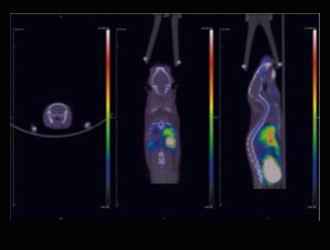 Cases study 3: The ability of drugs to cross the blood-brain barrier