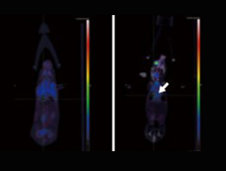 Cases study 6: Lung cancer in situ